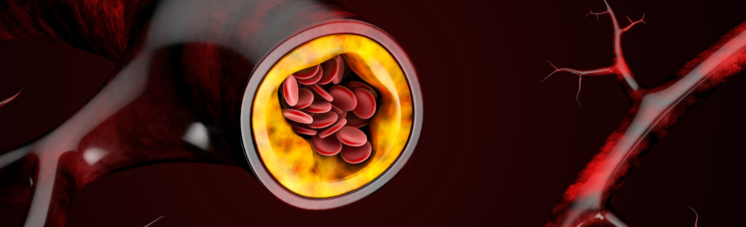 ValAsta for Cholesterol